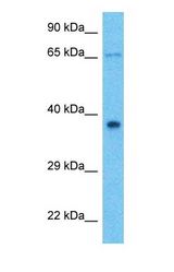 Western blot of ANKRD2 Antibody with human Fetal Liver lysate.