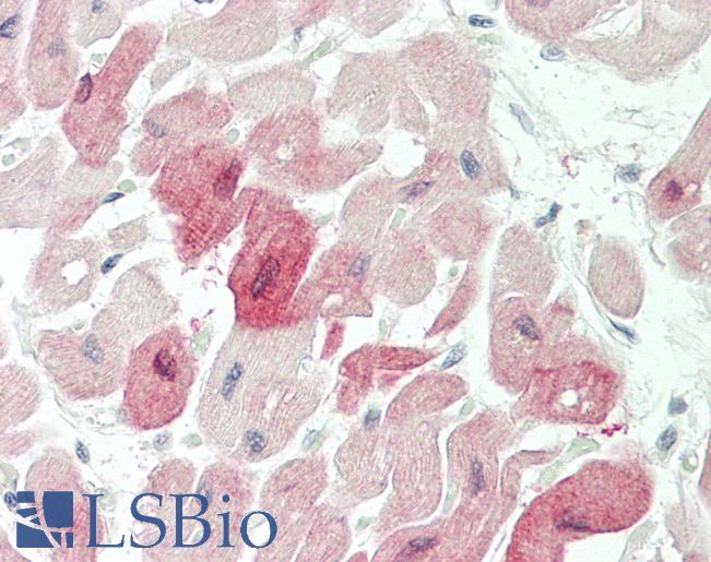 Human Heart: Formalin-Fixed, Paraffin-Embedded (FFPE)