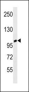 ANKRD20A3 Antibody western blot of MDA-MB453 cell line lysates (35 ug/lane). The ANKRD20A3 antibody detected the ANKRD20A3 protein (arrow).
