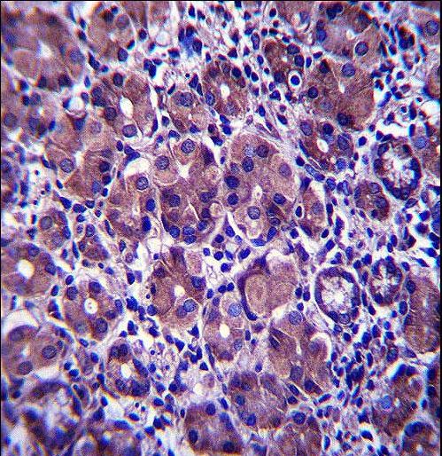 ANKRD22 Antibody immunohistochemistry of formalin-fixed and paraffin-embedded human stomach tissue followed by peroxidase-conjugated secondary antibody and DAB staining.