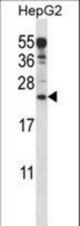 ANKRD22 Antibody western blot of HepG2 cell line lysates (35 ug/lane). The ANKRD22 antibody detected the ANKRD22 protein (arrow).