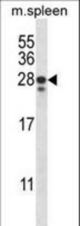 ANKRD22 Antibody western blot of mouse spleen tissue lysates (35 ug/lane). The ANKRD22 antibody detected the ANKRD22 protein (arrow).