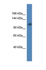 ANKRD27 antibody LS-C135499 Western blot of MCF7 Cell lysate. Antibody concentration 1 ug/ml.