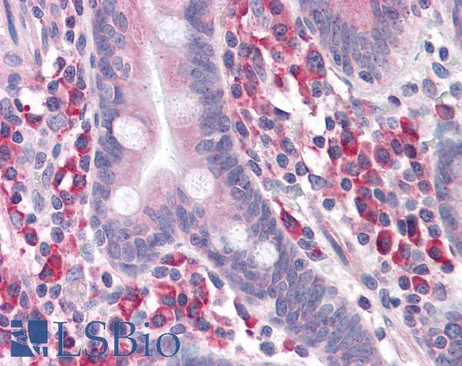 Anti-ANKRD27 antibody IHC of human small intestine. Immunohistochemistry of formalin-fixed, paraffin-embedded tissue after heat-induced antigen retrieval. Antibody LS-B4720 concentration 5 ug/ml.