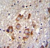 ANKRD34B Antibody immunohistochemistry of formalin-fixed and paraffin-embedded human brain tissue followed by peroxidase-conjugated secondary antibody and DAB staining.