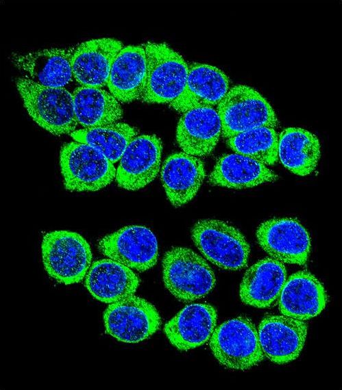 Confocal immunofluorescent of ANKRD34B Antibody with 293 cell followed by Alexa Fluor 488-conjugated goat anti-rabbit lgG (green). DAPI was used to stain the cell nuclear (blue).
