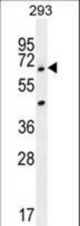 ANKRD34B Antibody western blot of 293 cell line lysates (35 ug/lane). The ANKRD34B antibody detected the ANKRD34B protein (arrow).