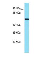 Western blot of ANKRD34B Antibody - N-terminal region with human 721_B cells lysate.