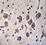 ANKRD34C Antibody immunohistochemistry of formalin-fixed and paraffin-embedded human brain tissue followed by peroxidase-conjugated secondary antibody and DAB staining.