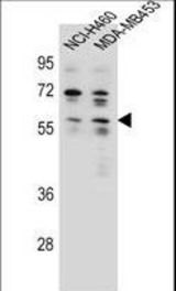 ANKRD34C Antibody western blot of NCI-H460,MDA-MB453 cell line lysates (35 ug/lane). The ANKRD34C antibody detected the ANKRD34C protein (arrow).