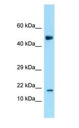 ANKRD37 antibody Western Blot of Mouse Spleen.