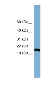 ANKRD37 antibody LS-C107907 Western blot of Jurkat lysate.