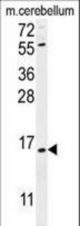 ANR39 Antibody western blot of mouse cerebellum tissue lysates (35 ug/lane). The ANR39 antibody detected the ANR39 protein (arrow).