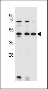 ANKRD40 Antibody western blot of 293,HL-60,MCF-7 cell line lysates (35 ug/lane). The ANKRD40 antibody detected the ANKRD40 protein (arrow).