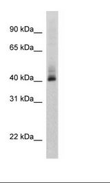 MCF7 Cell Lysate