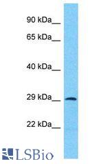 ANKRD44 antibody Western Blot of 721_B. Antibody dilution: 1 ug/ml.