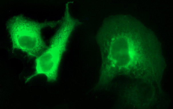 Anti-ANKRD49 mouse monoclonal antibody immunofluorescent staining of COS7 cells transiently transfected by pCMV6-ENTRY ANKRD49.