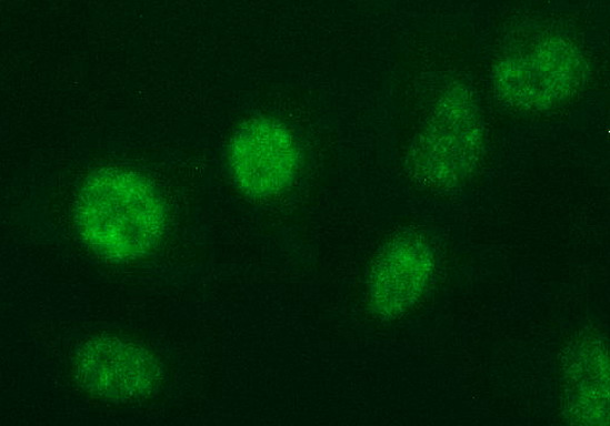 Immunofluorescent staining of HeLa cells using anti-ANKRD49 mouse monoclonal antibody.