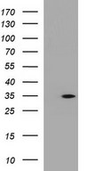 HEK293T cells were transfected with the pCMV6-ENTRY control (Left lane) or pCMV6-ENTRY ANKRD49 (Right lane) cDNA for 48 hrs and lysed. Equivalent amounts of cell lysates (5 ug per lane) were separated by SDS-PAGE and immunoblotted with anti-ANKRD49.