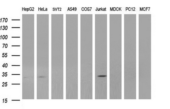 Western blot of extracts (35ug) from 9 different cell lines by using anti-ANKRD49 monoclonal antibody (HepG2: human; HeLa: human; SVT2: mouse; A549: human; COS7: monkey; Jurkat: human; MDCK: canine; PC12: rat; MCF7: human).