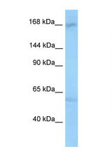 ANKRD50 antibody LS-C146365 Western blot of Rat Lung lysate. Antibody concentration 1 ug/ml.