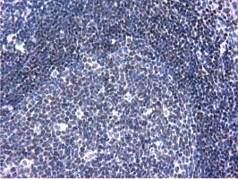 IHC of paraffin-embedded Human lymph node tissue using anti-ANKRD53 mouse monoclonal antibody.