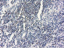 IHC of paraffin-embedded Human lymphoma tissue using anti-ANKRD53 mouse monoclonal antibody.