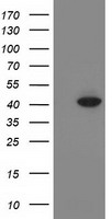 HEK293T cells were transfected with the pCMV6-ENTRY control (Left lane) or pCMV6-ENTRY ANKRD53 (Right lane) cDNA for 48 hrs and lysed. Equivalent amounts of cell lysates (5 ug per lane) were separated by SDS-PAGE and immunoblotted with anti-ANKRD53.