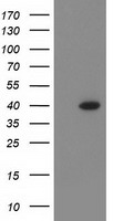 HEK293T cells were transfected with the pCMV6-ENTRY control (Left lane) or pCMV6-ENTRY ANKRD53 (Right lane) cDNA for 48 hrs and lysed. Equivalent amounts of cell lysates (5 ug per lane) were separated by SDS-PAGE and immunoblotted with anti-ANKRD53.