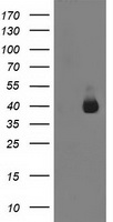 HEK293T cells were transfected with the pCMV6-ENTRY control (Left lane) or pCMV6-ENTRY ANKRD53 (Right lane) cDNA for 48 hrs and lysed. Equivalent amounts of cell lysates (5 ug per lane) were separated by SDS-PAGE and immunoblotted with anti-ANKRD53.