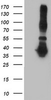 HEK293T cells were transfected with the pCMV6-ENTRY control (Left lane) or pCMV6-ENTRY ANKRD53 (Right lane) cDNA for 48 hrs and lysed. Equivalent amounts of cell lysates (5 ug per lane) were separated by SDS-PAGE and immunoblotted with anti-ANKRD53.