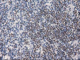 IHC of paraffin-embedded Human lymphoma tissue using anti-ANKRD53 mouse monoclonal antibody.