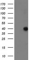 HEK293T cells were transfected with the pCMV6-ENTRY control (Left lane) or pCMV6-ENTRY ANKRD53 (Right lane) cDNA for 48 hrs and lysed. Equivalent amounts of cell lysates (5 ug per lane) were separated by SDS-PAGE and immunoblotted with anti-ANKRD53.
