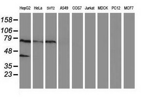 Western blot of extracts (35 ug) from 9 different cell lines by using anti-ANKRD53 monoclonal antibody.