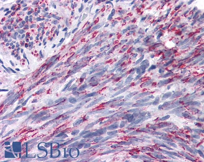 Anti-ANKRD54 antibody IHC of human uterus. Immunohistochemistry of formalin-fixed, paraffin-embedded tissue after heat-induced antigen retrieval. Antibody LS-B4608 concentration 5 ug/ml.