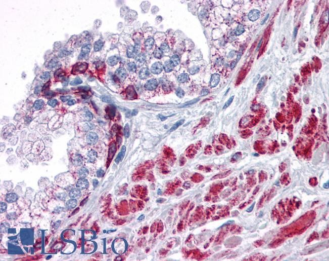 Anti-ANKRD54 antibody IHC of human prostate. Immunohistochemistry of formalin-fixed, paraffin-embedded tissue after heat-induced antigen retrieval. Antibody LS-B4608 concentration 5 ug/ml.
