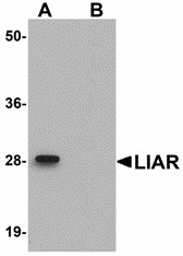 Western blot of ANKRD54 in mouse kidney tissue lysate with ANKRD54 antibody at 1 ug/ml in (A) the absence and (B) the presence of blocking peptide.