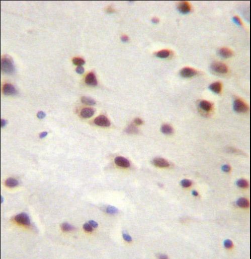 ANKRD6 Antibody immunohistochemistry of formalin-fixed and paraffin-embedded human brain tissue followed by peroxidase-conjugated secondary antibody and DAB staining.