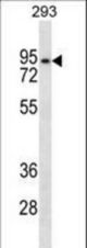 ANKRD6 Antibody western blot of 293 cell line lysates (35 ug/lane). The ANKRD6 antibody detected the ANKRD6 protein (arrow).