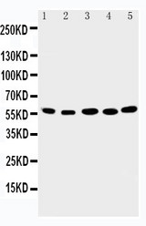 WB of ABI2B / ABI2 antibody. Lane 1: Rat Brain Tissue Lysate. Lane 2: Human Placenta Tissue Lysate. Lane 3: MCF-7 Cell Lysate. Lane 4: HELA Cell Lysate. Lane 5: JURKAT Cell Lysate.