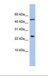 721_B cell lysate. Antibody concentration: 1.0 ug/ml. Gel concentration: 10-20%.