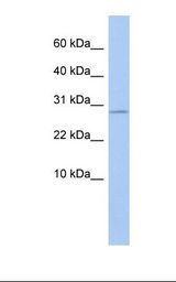 Placenta lysate. Antibody concentration: 1.0 ug/ml. Gel concentration: 10-20%.