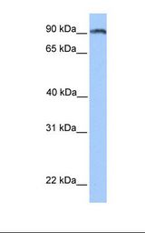 Hela cell lysate. Antibody concentration: 1.0 ug/ml. Gel concentration: 12%.