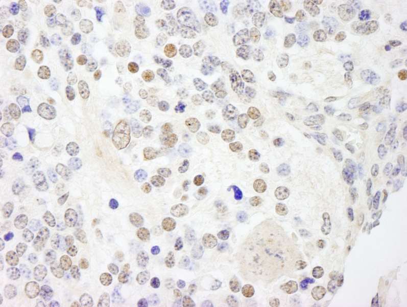 Detection of Mouse ANKS3 by Immunohistochemistry. Sample: FFPE section of mouse teratoma. Antibody: Affinity purified rabbit anti-ANKS3 used at a dilution of 1:250.