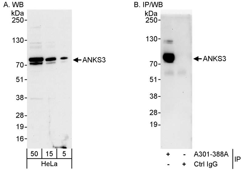 Detection of Human ANKS3 by Western Blot and Immunoprecipitation. Samples: Whole cell lysate (5, 15 and 50 ug for WB; 1 mg for IP, 20% of IP loaded) from HeLa cells. Antibody: Affinity purified rabbit anti-ANKS3 antibody used for WB at 0.04 ug/ml (A) and 1 ug/ml (B) and used for IP at 3 ug/mg lysate. Detection: Chemiluminescence with exposure times of 10 seconds (A and B).