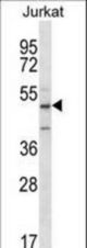 ABI2 Antibody western blot of Jurkat cell line lysates (35 ug/lane). The ABI2 antibody detected the ABI2 protein (arrow).