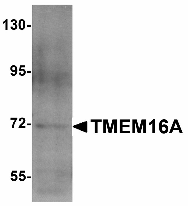 Western blot of TMEM16A in A549 cell lysate with TMEM16A antibody at 1 ug/ml.