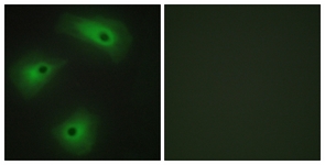 Immunofluorescence of HeLa cells, using TM16A Antibody. The sample on the right was incubated with synthetic peptide.