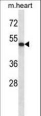 ABI2 Antibody western blot of mouse heart tissue lysates (35 ug/lane). The ABI2 antibody detected the ABI2 protein (arrow).