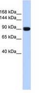 Western blot of fetal muscle lysate.